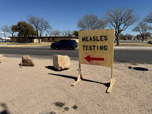 Texas ‘cautiously optimistic’ as measles spread slows, cases rise by one to 729